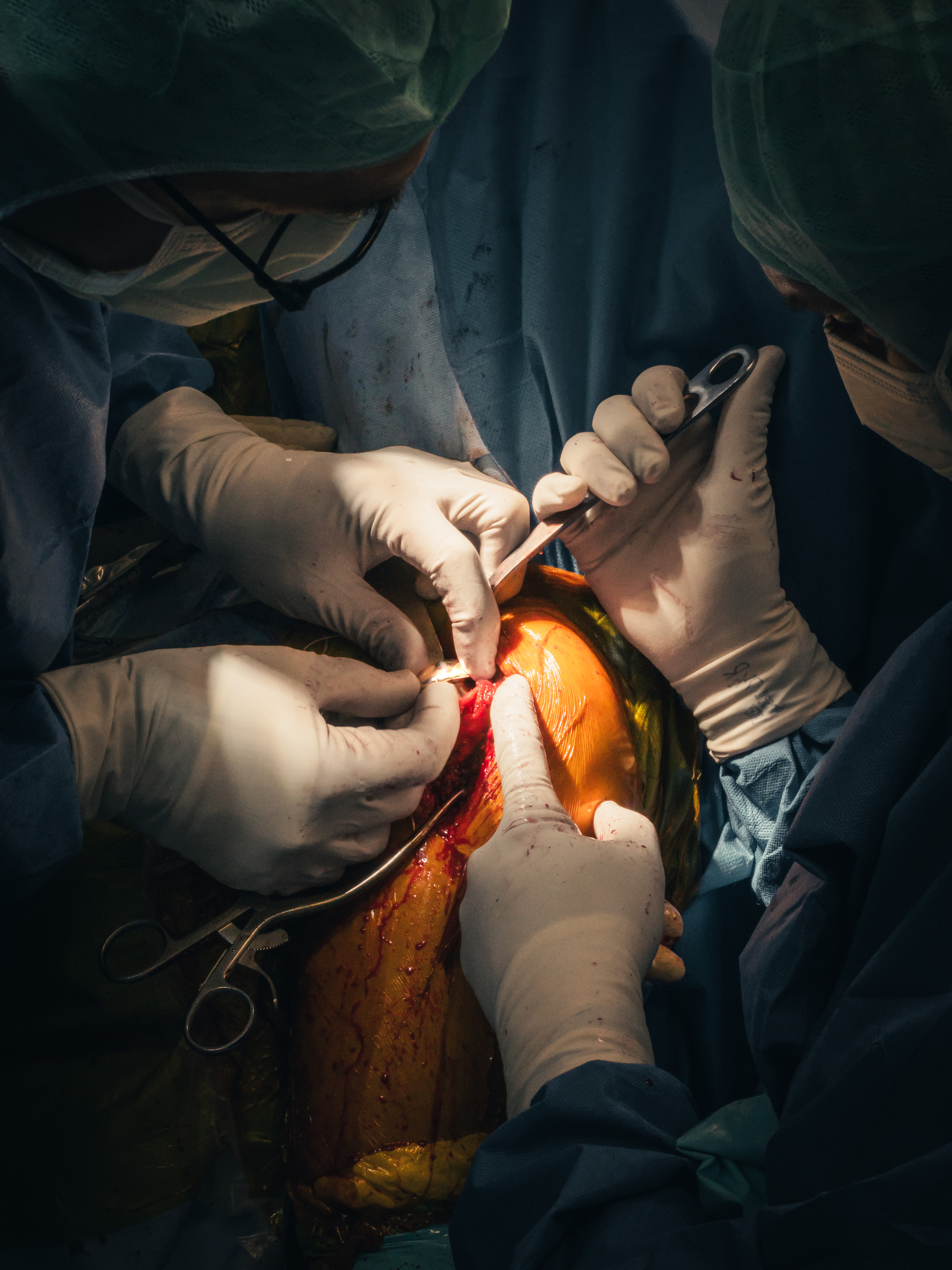 3 months in a surgery room.